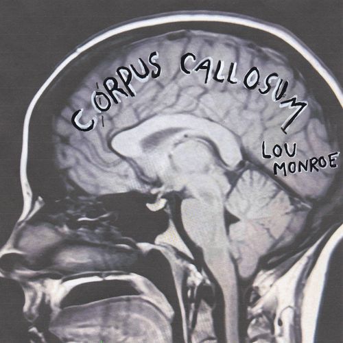 Lou Monroe - Corpus Callosum
